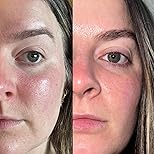 Anua Rice 70 Glow Milky Toner 250ml | Brightening & Hydrating Toner